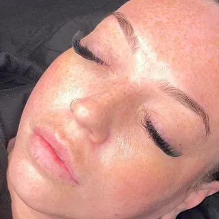 Fresh, glowing skin after a facial treatment