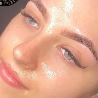 Glowing result of a Million Dollar dermaplane facial