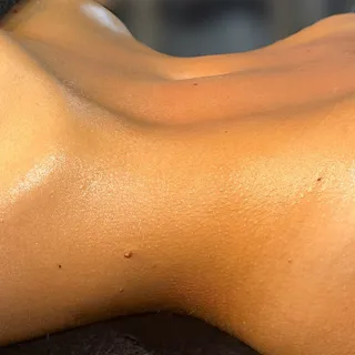 Sculpted waistline during a body sculpting treatment