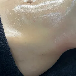 Contoured waist glowing after a body sculpting session